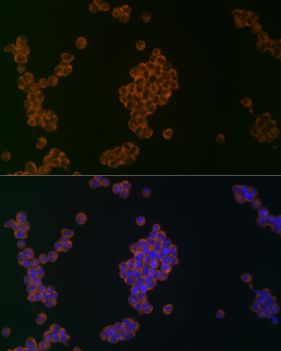 Rabbit anti-ATG5 Polyclonal Antibody