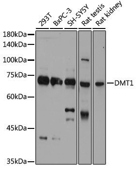 Rabbit anti-SLC11A2 Polyclonal Antibody