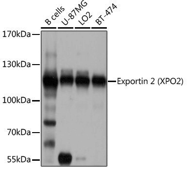 Rabbit anti-CSE1L Polyclonal Antibody