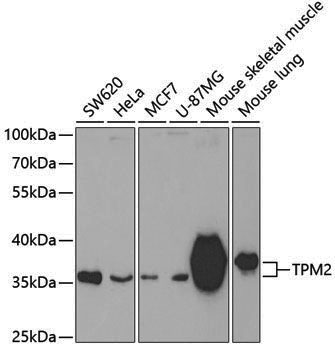 Rabbit anti-TPM2 Polyclonal Antibody