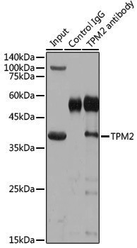Rabbit anti-TPM2 Polyclonal Antibody