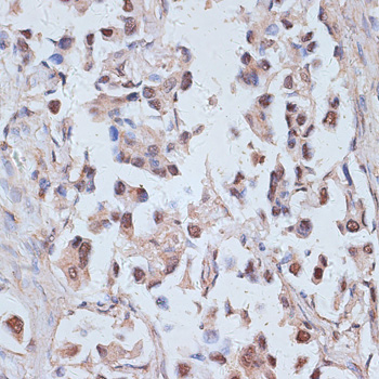 Rabbit anti-TAX1BP1 Polyclonal Antibody