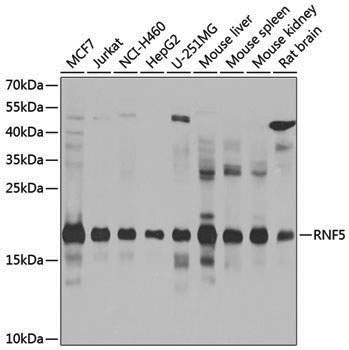 Rabbit anti-RNF5 Polyclonal Antibody