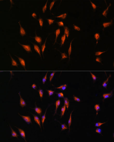 Rabbit anti-MMP9 Polyclonal Antibody