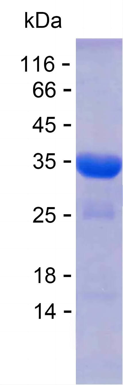 Recombinant Human INTS3 Protein(C-His)