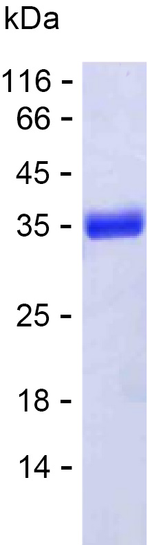 Recombinant Human YBX3 Protein(C-His)