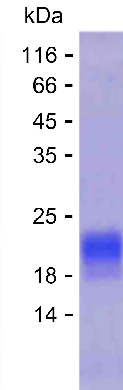 Recombinant Human MINAR1 Protein(C-His)