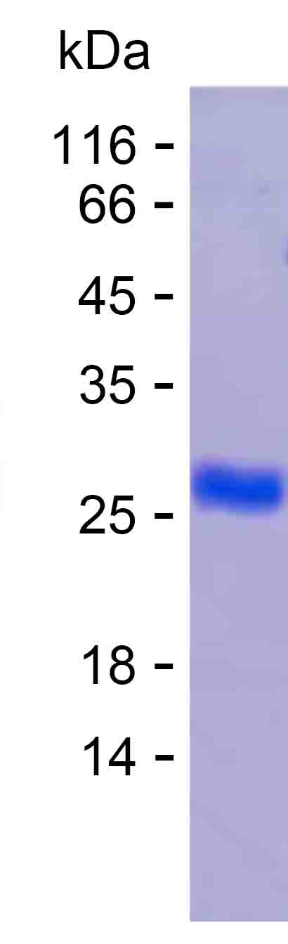 Recombinant Human GSTA4 Protein(C-His)