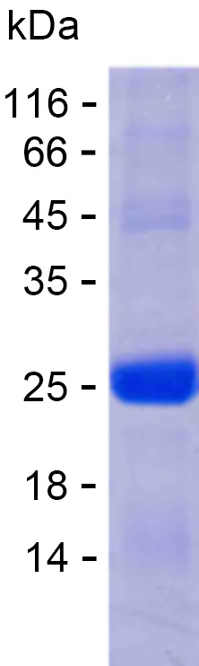 Recombinant Human RAD51D Protein(C-His)