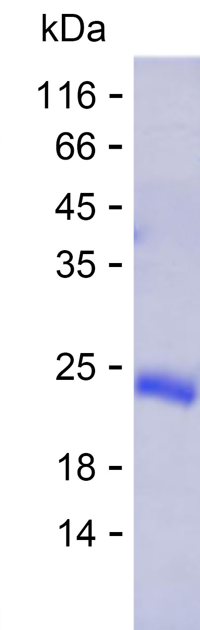Recombinant Human MOCOS Protein(C-His)