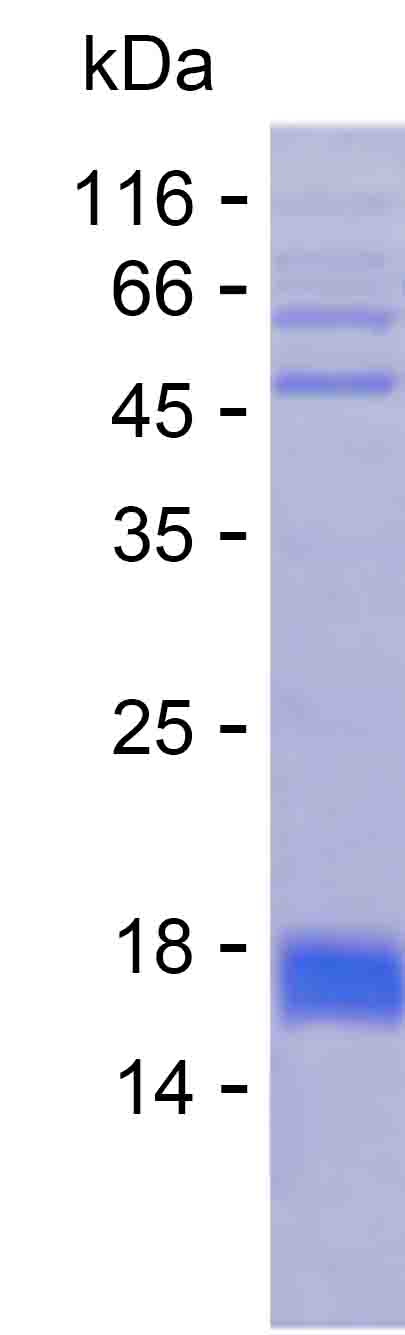 Recombinant Human MED31 Protein(C-His)