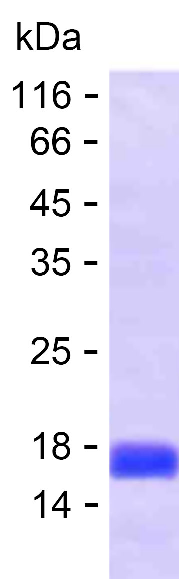 Recombinant Human USP17L1 Protein(C-His)