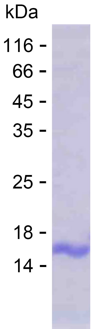 Recombinant Human AMIGO2 Protein(C-His)