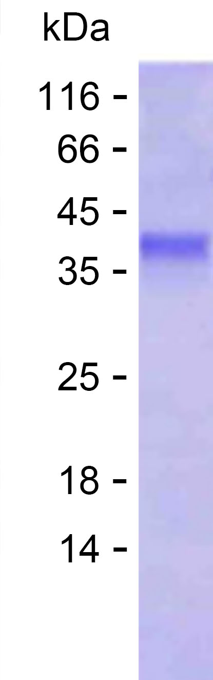 Recombinant Human CHD5 Protein(C-His)