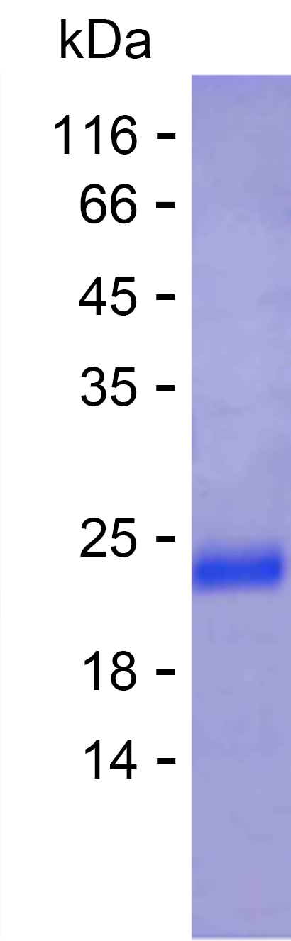 Recombinant Human SOD2 Protein(C-His)