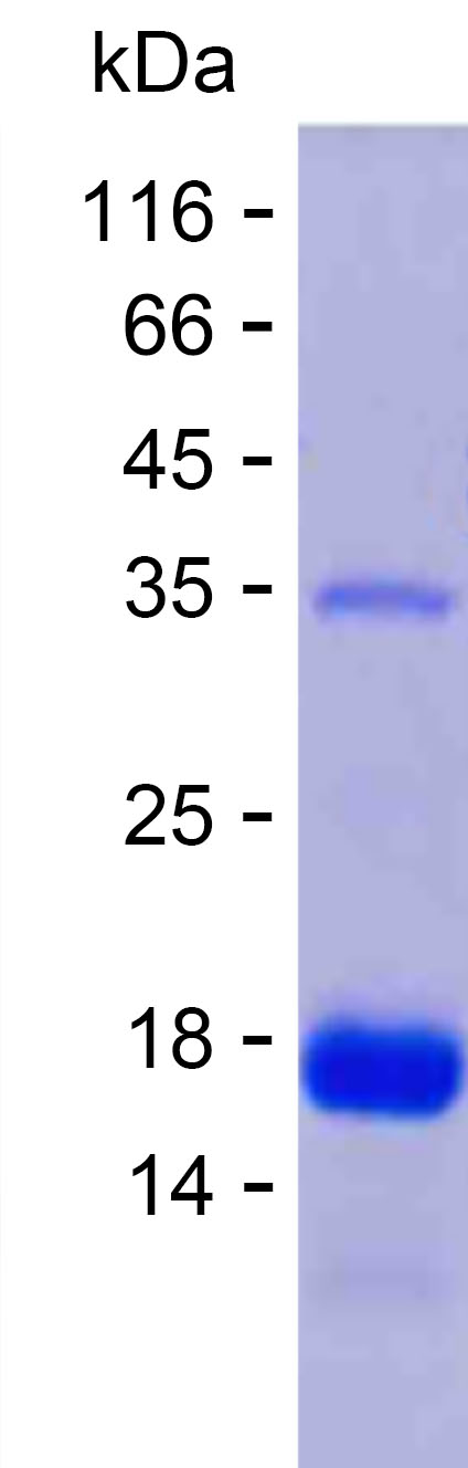 Recombinant Human PTS Protein(C-His)