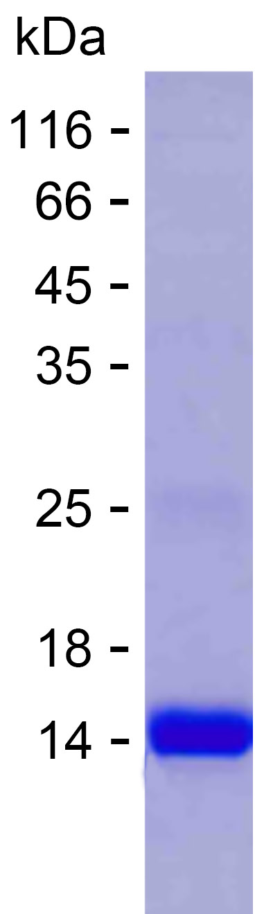 Recombinant Human ZNF626 Protein(C-His)