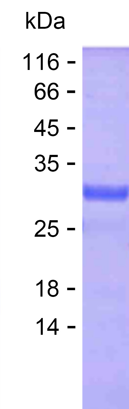 Recombinant Human THUMPD3 Protein(C-His)