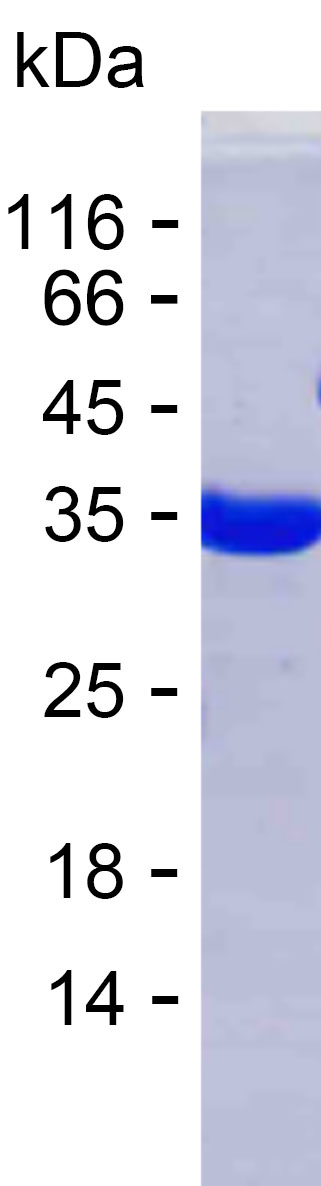 Recombinant Human ESD Protein(C-His)