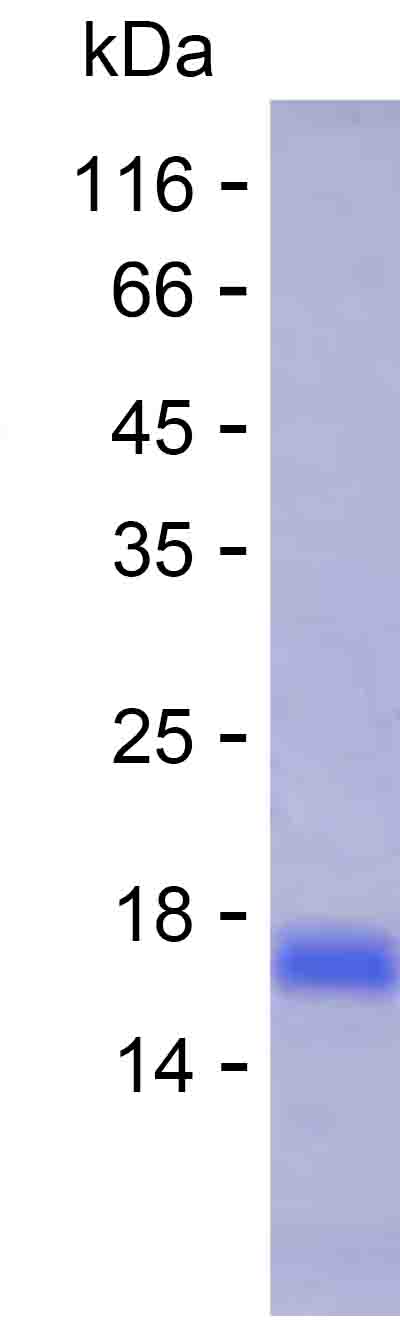 Recombinant Human KLHL34 Protein(C-His)