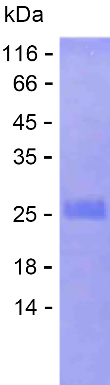 Recombinant Human ARL10 Protein(C-His)