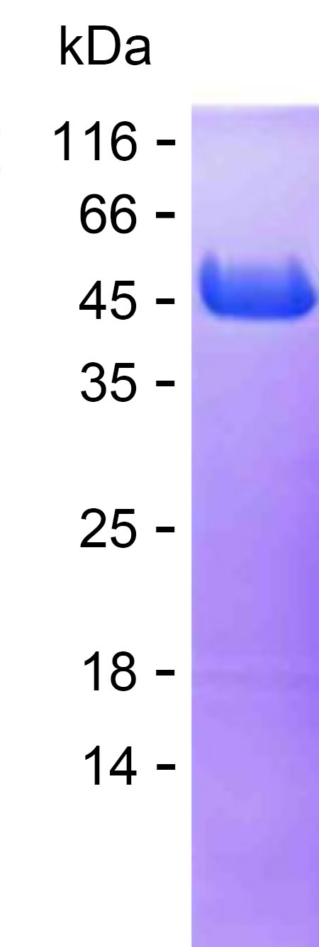 Recombinant Human ASS1 Protein(C-His)