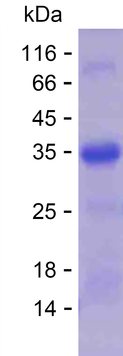 Recombinant Human BACH1 Protein(C-His)