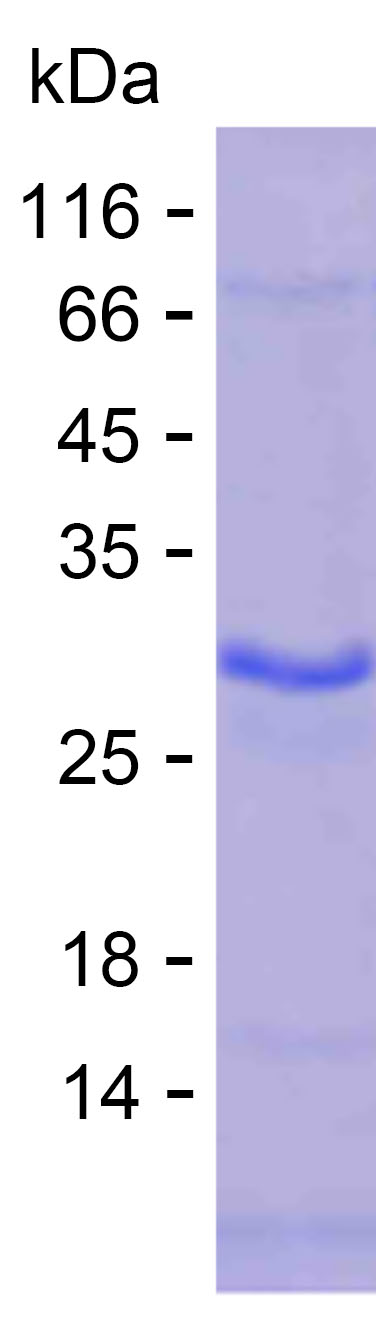 Recombinant Human KDM4A Protein(C-His)