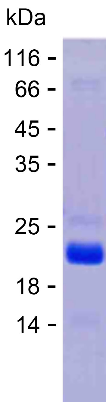 Recombinant Human G3BP2 Protein(C-His)