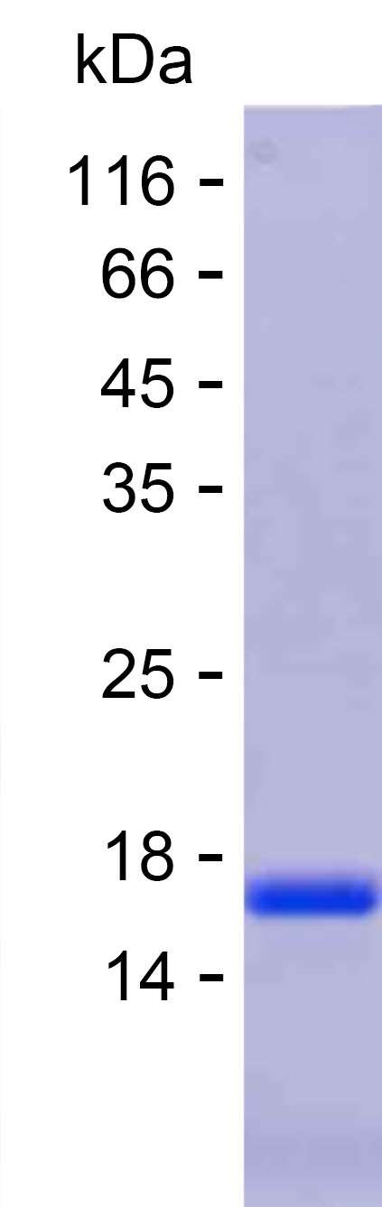Recombinant Human TOX4 Protein(C-His)