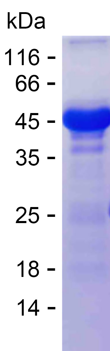 Recombinant Human TDRKH Protein(N-SUMO & N-His)
