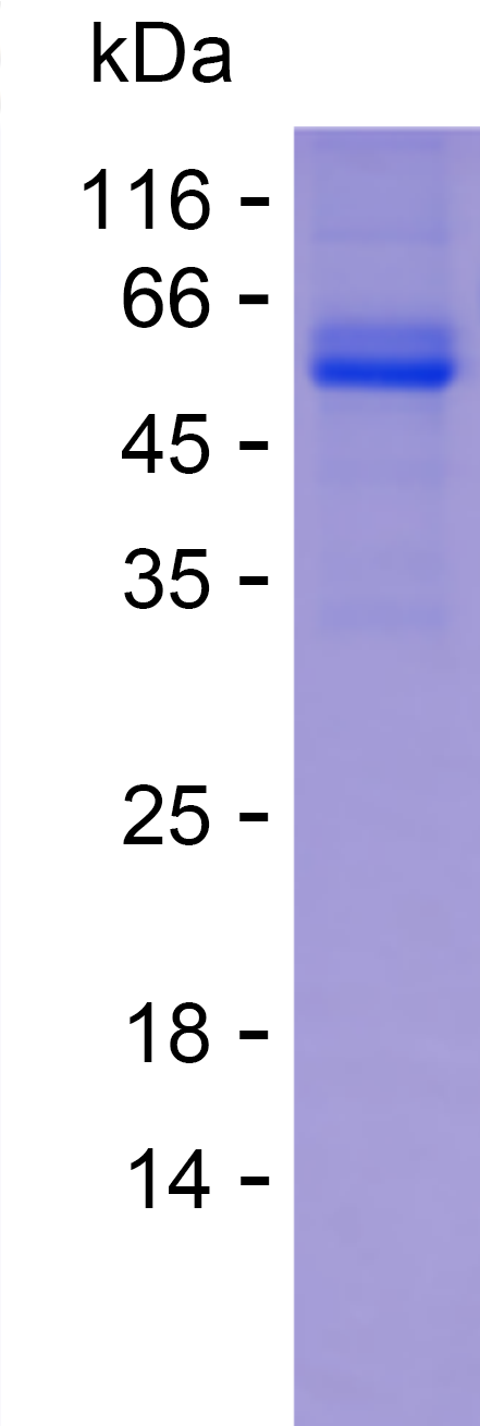 Recombinant Human CNNM2 Protein(C-hFc & C-His)