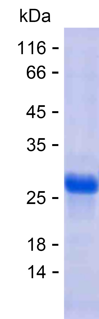 Recombinant Human GOLGA6C Protein(C-His)
