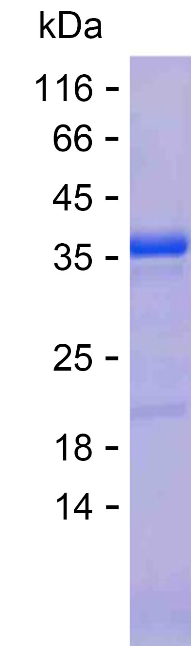Recombinant Human PALMD Protein(C-His)