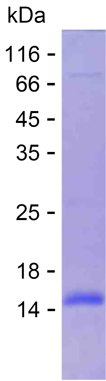 Recombinant Human COX5B Protein(C-His)