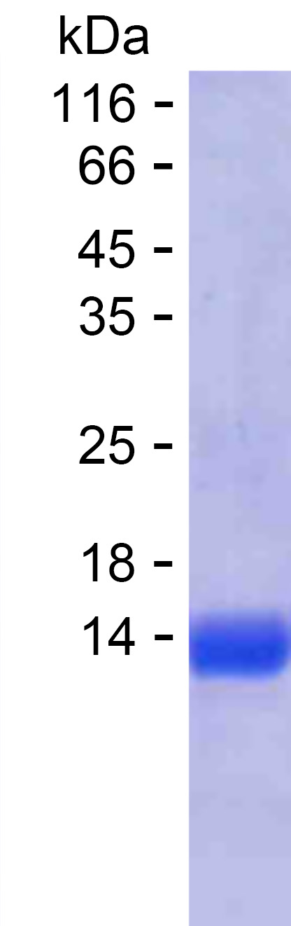 Recombinant Human ANKRD66 Protein(C-His)