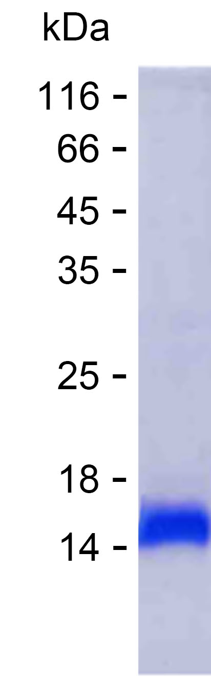 Recombinant Human ZNF793 Protein(C-His)