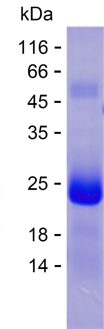 Recombinant Human ZNF223 Protein(C-His)