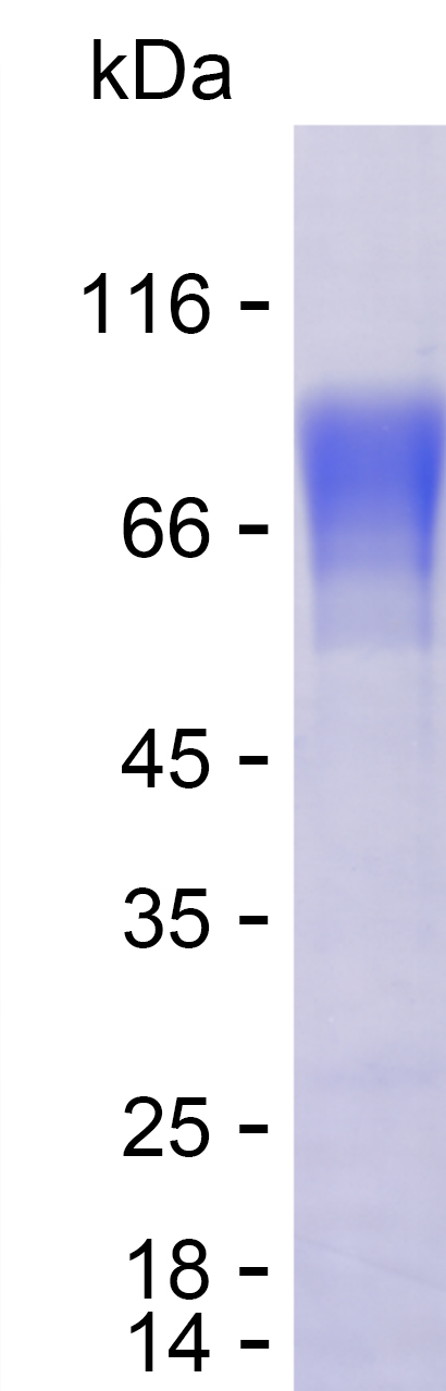 Recombinant Human NFASC Protein(C-hFc & C-His)