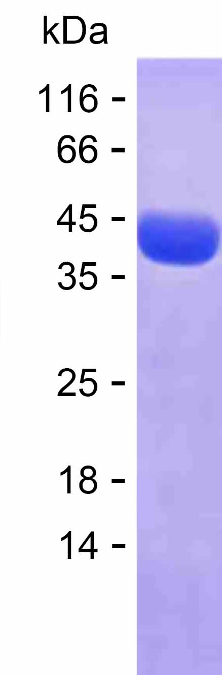 Recombinant Human CNKSR3 Protein(C-His)