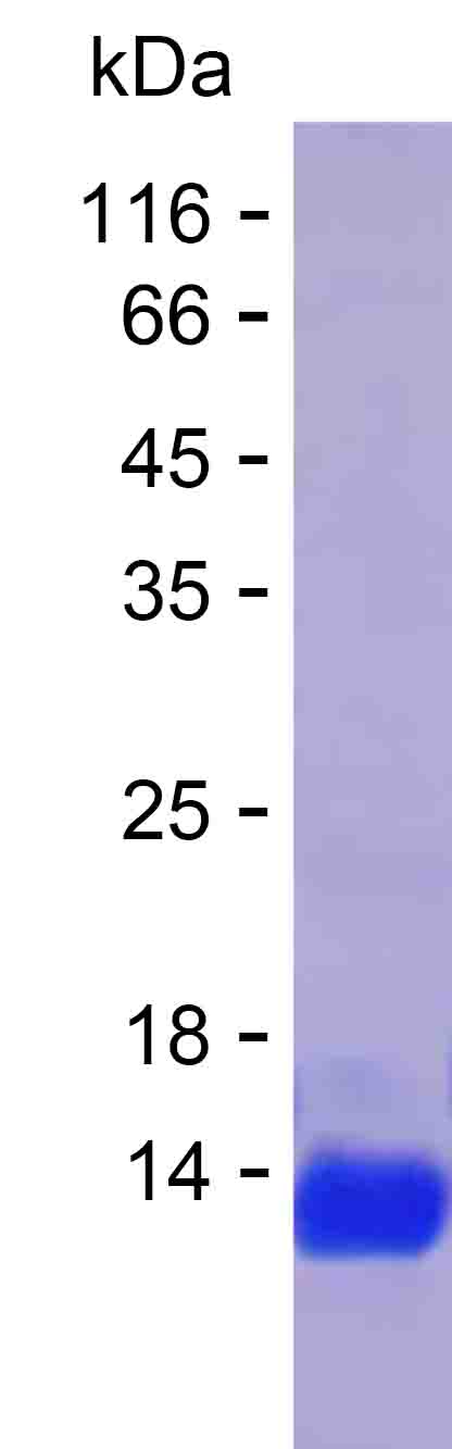 Recombinant Human ZNF732 Protein(C-His)