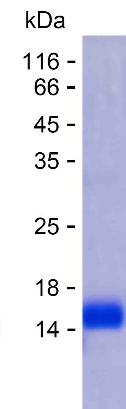 Recombinant Human ZNF738 Protein(C-His)