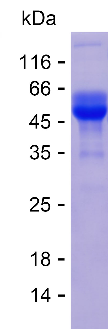 Recombinant Human KIAA0319 Protein(C-hFc & C-His)