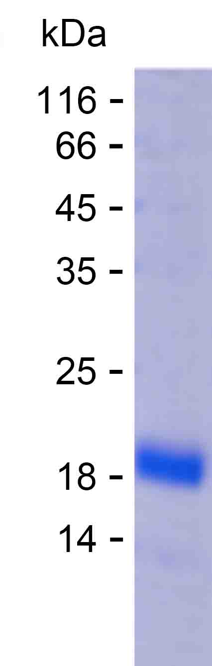 Recombinant Human COPS8 Protein(C-His)