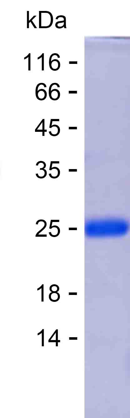 Recombinant Human ADGRE2 Protein(C-His)