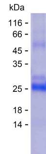 Recombinant Human TNNI1 Protein(C-His)