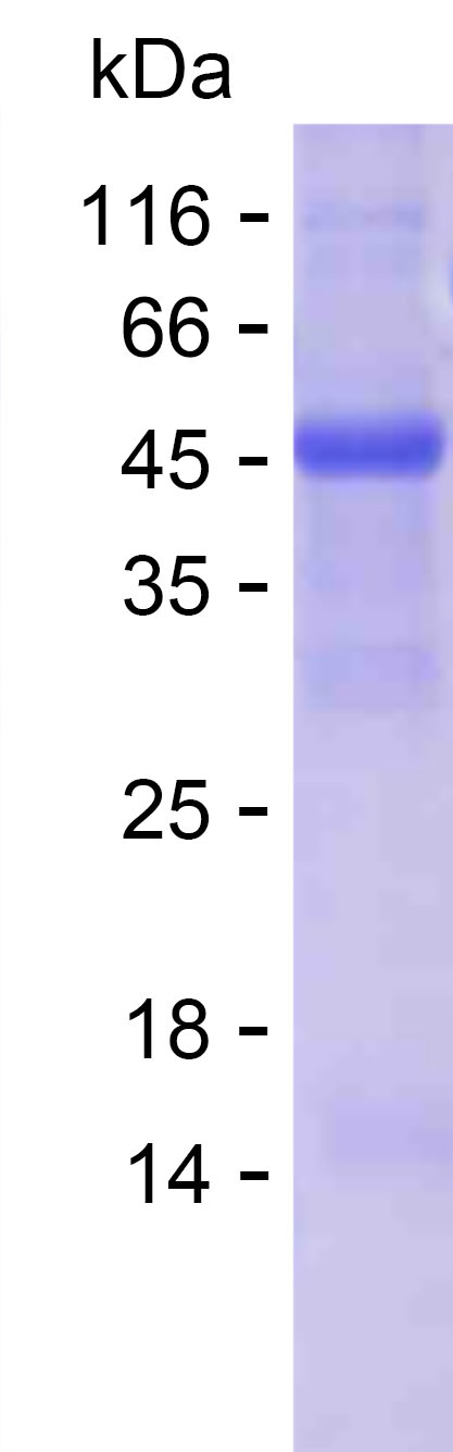 Recombinant Human ASNS Protein(C-His)