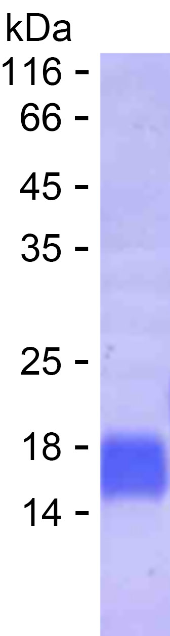 Recombinant Human HSFY1 Protein(C-His)