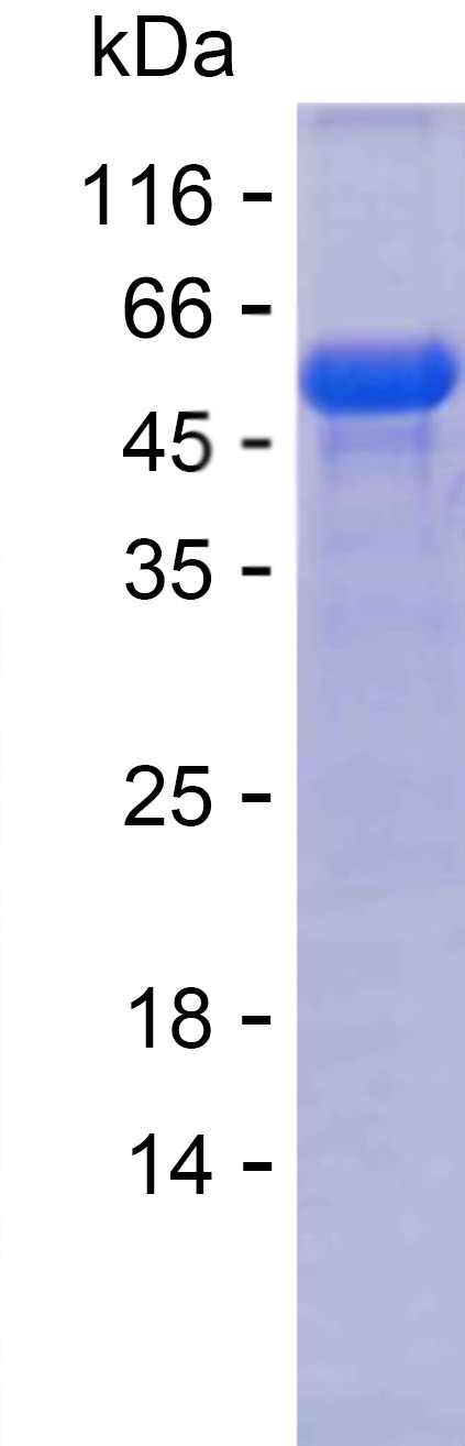 Recombinant Human ABCB5 Protein(N-SUMO & C-His)
