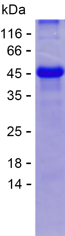 Recombinant Human SLC4A9 Protein(C-His)